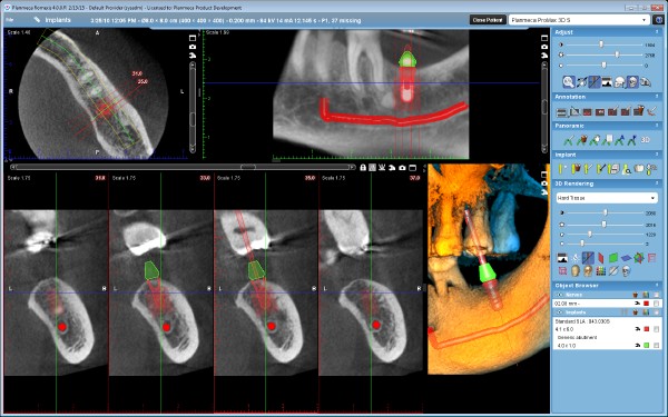 3-dimensional röntgen DVT